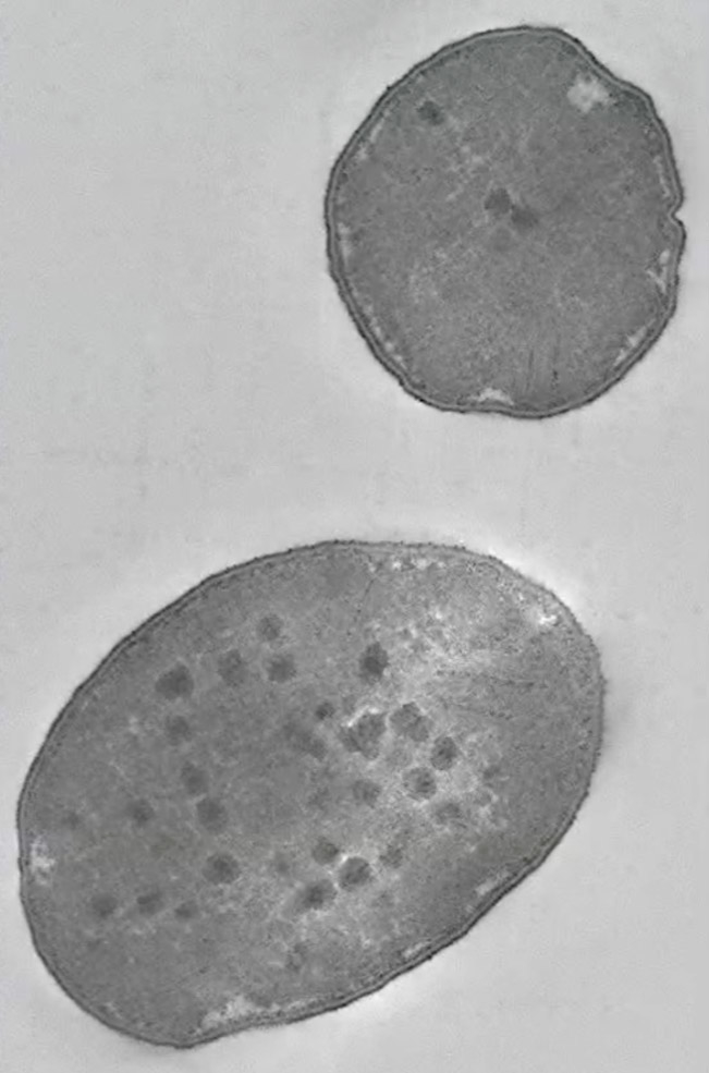 硫酸塩還元を行う単細胞微生物の顕微鏡写真（クレジット：Guy Perkins and Mark Ellisman, National Center for Microscopy and Imaging Research）