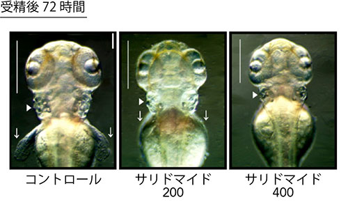 ゼブラフィッシュ胚の頭部に対するサリドマイドの影響