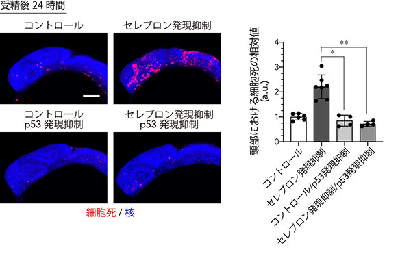 セレブロンの発現抑制は脳でp53依存的に細胞死を誘導する