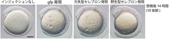 セレブロンの過剰発現による脳の拡大