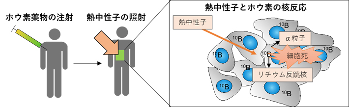 図1. BNCTの原理