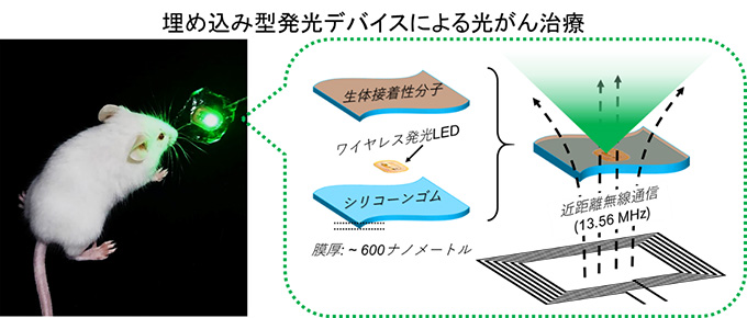 埋め込み型発行デバイスによる光がん治療