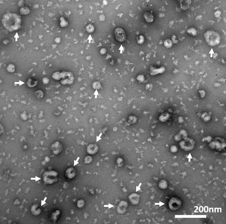 図1. エクソソームの電子顕微鏡写真