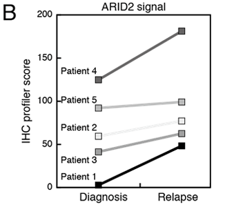B：初診時と再発時でのARID2発現の比較（n=5）。ARID2の発現レベルは再発時に高い。