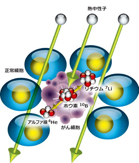 図1 BNCTの原理