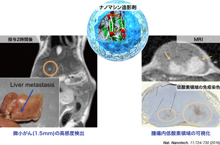 ナノマシン造影剤は、現在のMRI造影剤よりも高いコントラストでがんの検出を可能にする。またがんの組織の中でも、特に悪性度が高いとされる低酸素濃度や低pHの領域で信号が上がり白くなることで、診断情報の高度化を可能にする