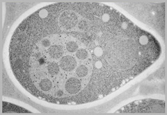 電子顕微鏡で捉えた飢餓状態にある酵母