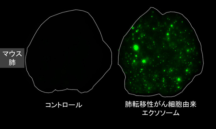 微粒子のエクソソームが、がん細胞よりも先に転移先に到達し、がん細胞が転移しやすいように、転移先の細胞を変化させておくことで、がん細胞は容易に転移できるということが明らかに。