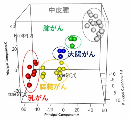 血液内のエクソソームをプロテオミクス解析することで、がんの有無を判別するだけでなく、がん種の特定を可能にした。軸の数字は相対的な値で、離れていればいるほど違う成分を持っていることを示す。